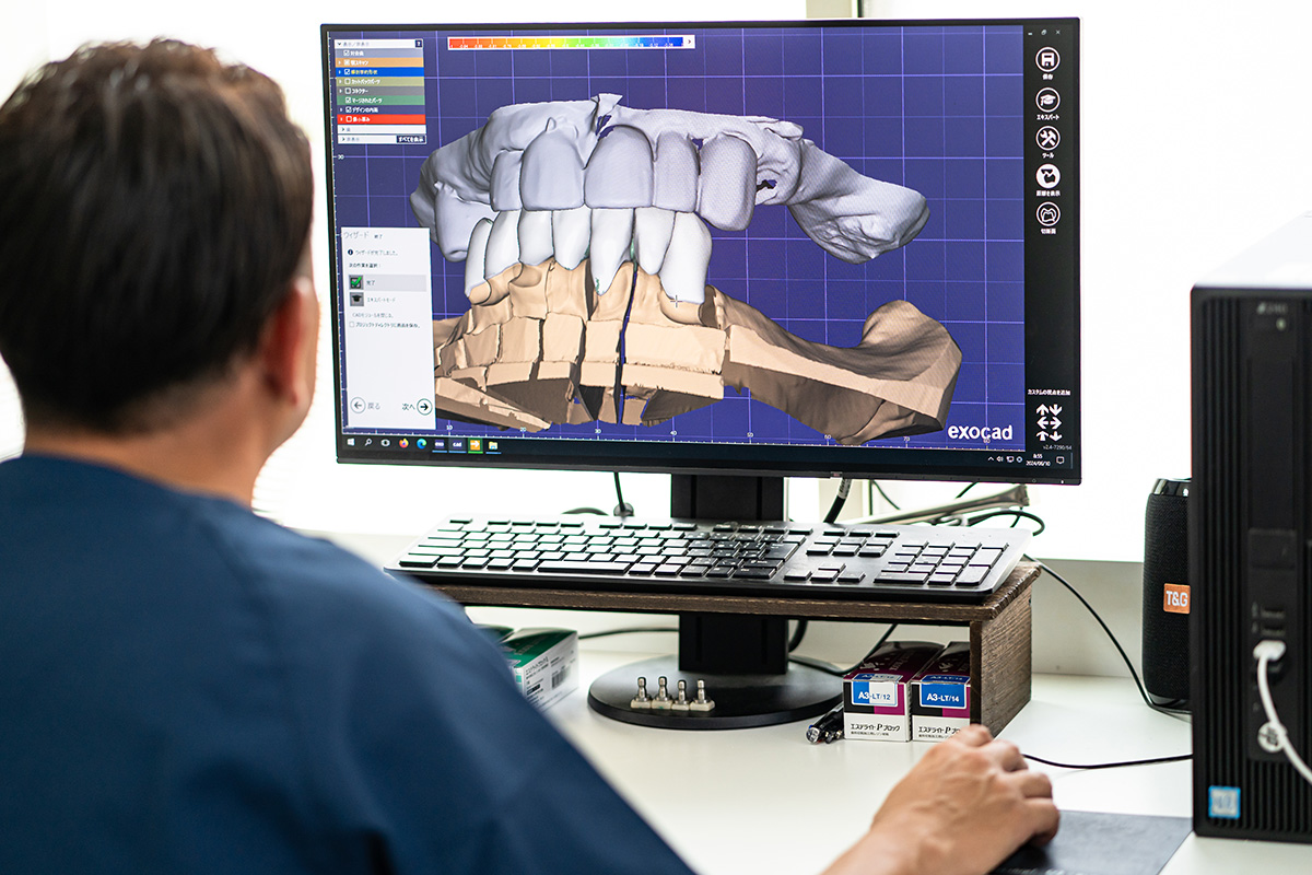 歯科技工士が常駐