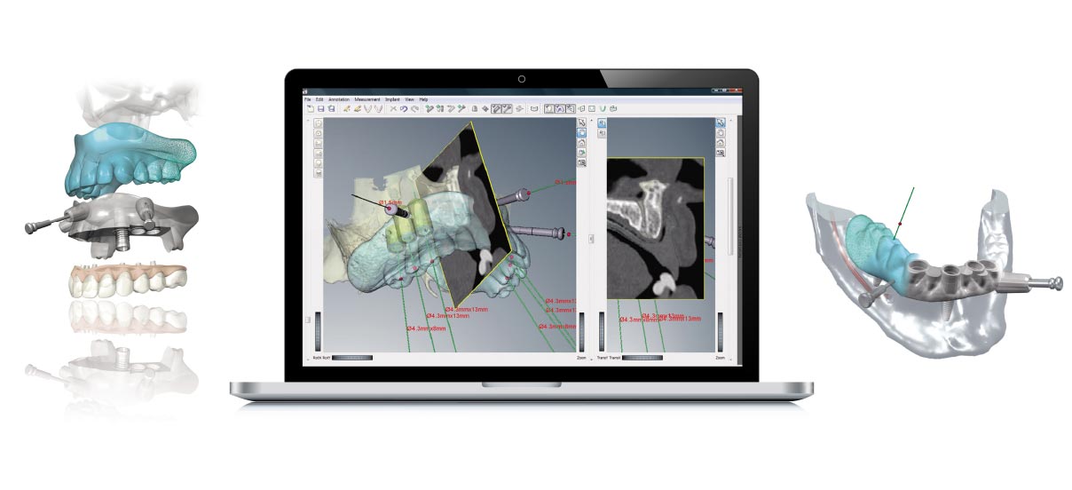 ガイデッドサージェリー