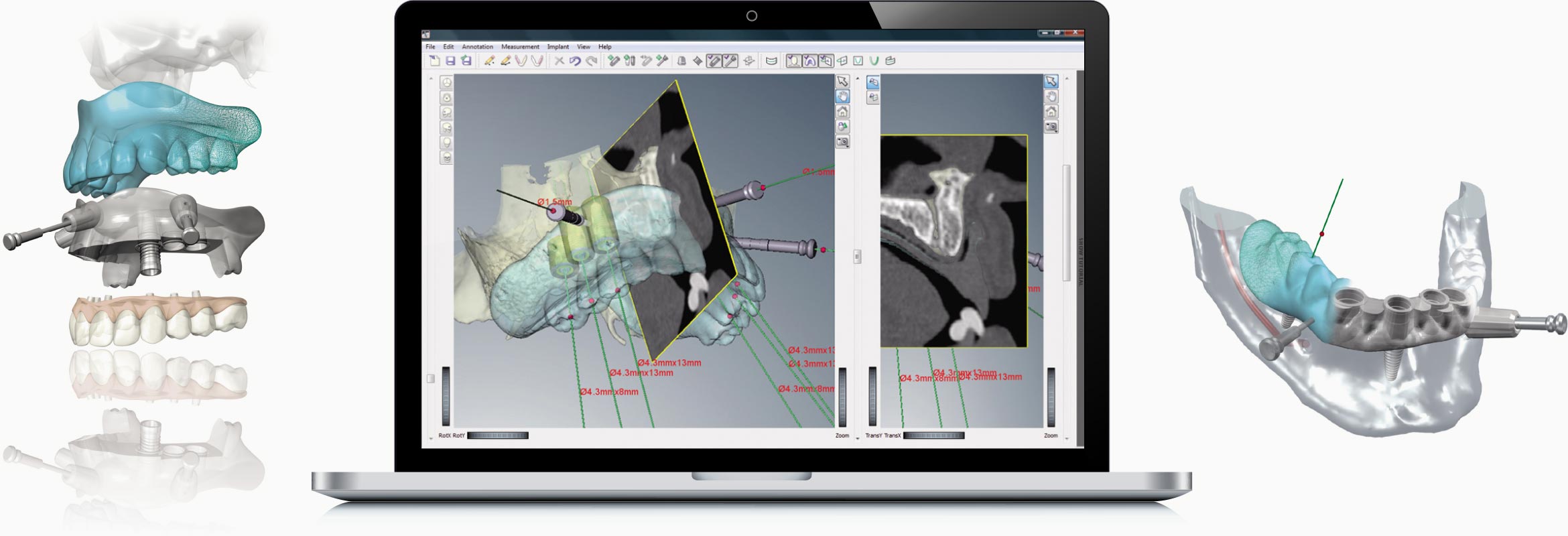 ガイデッドサージェリー