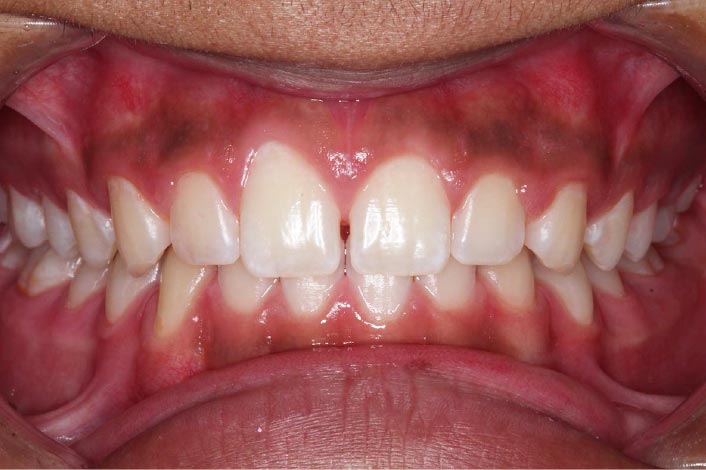 綺麗なりました!